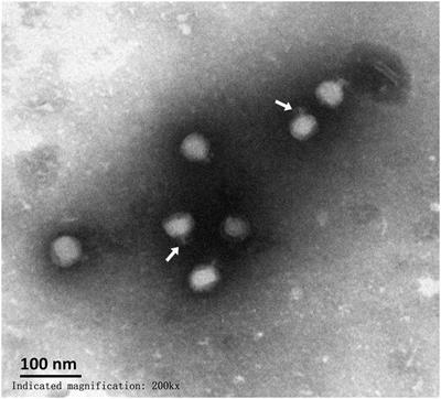 Characterization and Genomic Analyses of Pseudomonas aeruginosa Podovirus TC6: Establishment of Genus Pa11virus